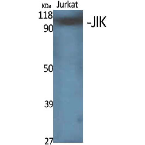 Polyclonal Rabbit anti-Human TAOK3 / JIK Antibody (500-580 aa, Internal, WB)