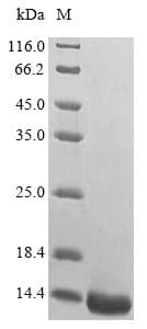 Mouse Dbil5 Protein (Recombinant 6His, N-terminus)
