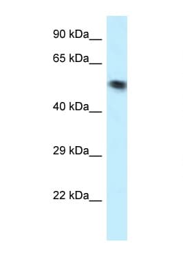 SKD1 / VPS4B Antibody (aa70-119)