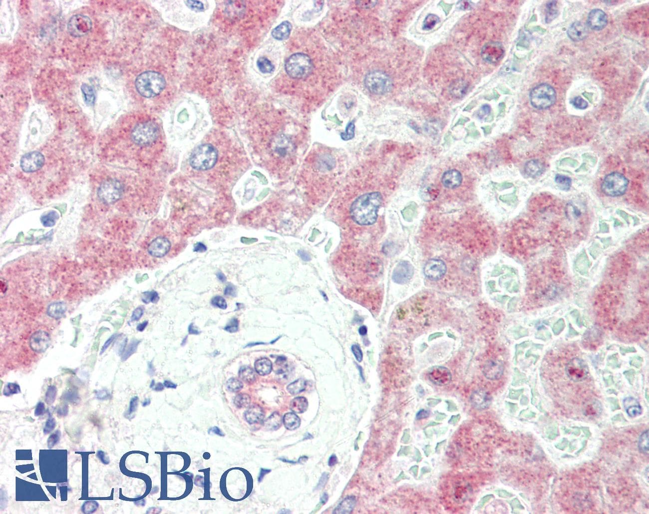 IHC-plus™ SPRY2 / Sprouty 2 Antibody (Internal)