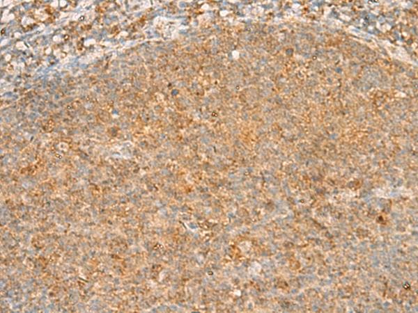 PPOX Antibody