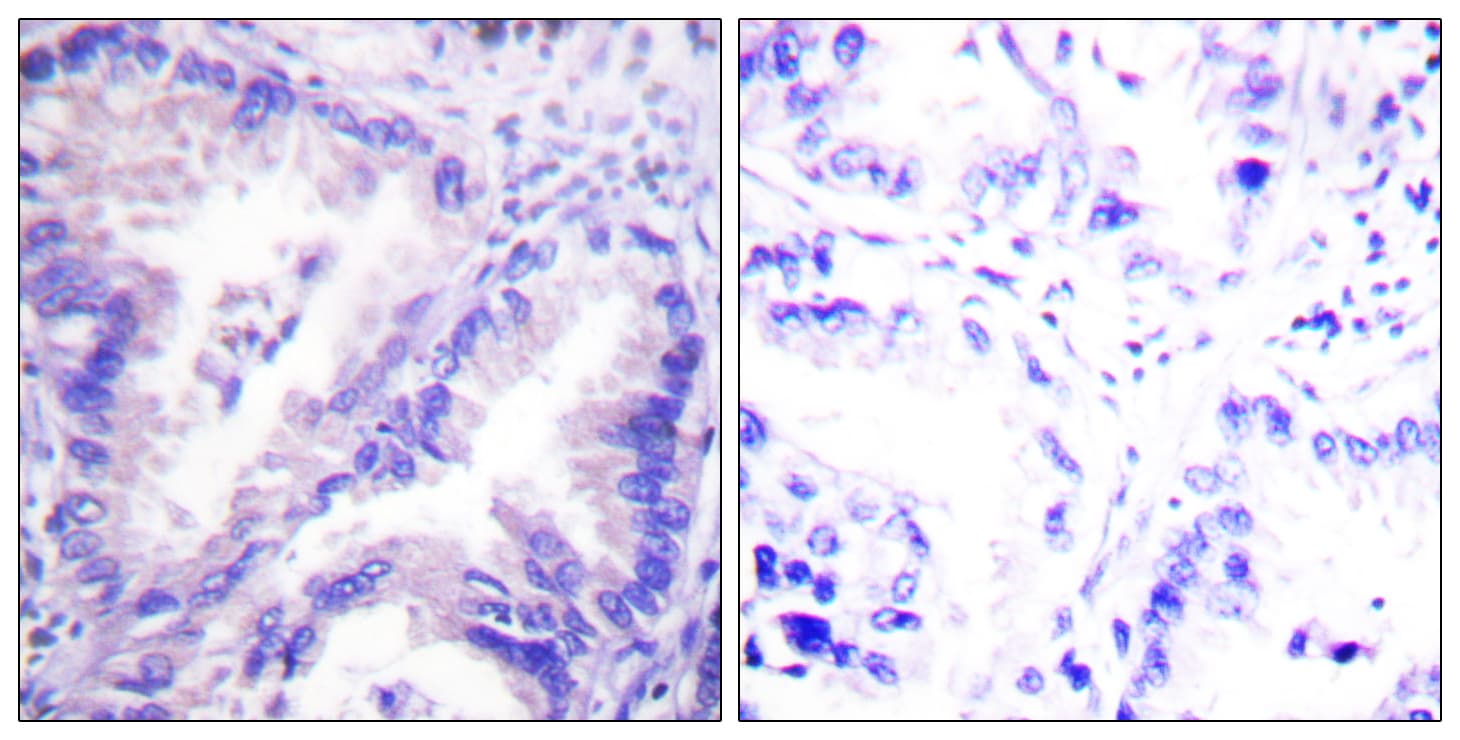 Polyclonal Rabbit anti-Human PP2Ac / PPP2CA Antibody (aa260-309, IHC, IF, WB)