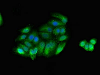 Polyclonal Rabbit anti-Human MYLK Antibody (IHC, IF)