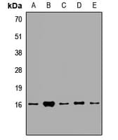 EIF1AY Antibody