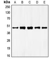 GATA4 Antibody (Internal)