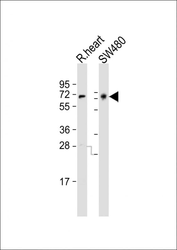 NGFR / CD271 / TNR16 Antibody (aa276-310)