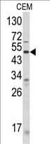 Polyclonal Rabbit anti-Human ANGPTL3 Antibody (aa82-114, WB)