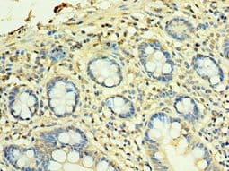 TFG Antibody (aa1-240)