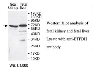 ETFDH Antibody (aa427-598)