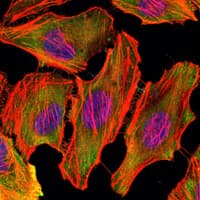 c-Src Kinase / CSK Antibody (clone 5F3)