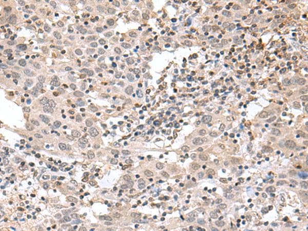 TDP2 / TTRAP Antibody