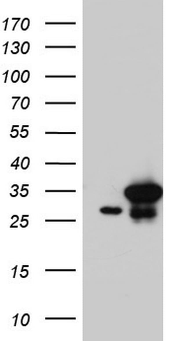 Monoclonal Mouse anti-Human C14orf166 Antibody (clone OTI2C3, IHC, WB)
