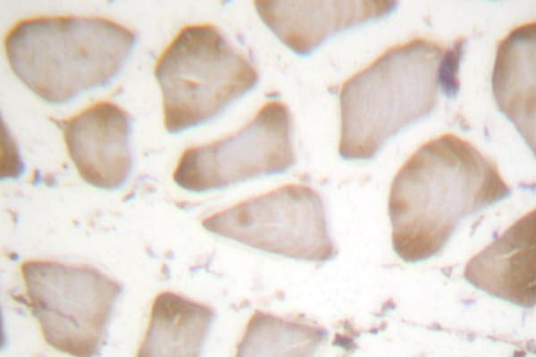 ALOX5 / 5-LOX Antibody (Glu267)