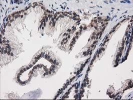 PRKCE / PKC-Epsilon Antibody (clone OTI1B7)