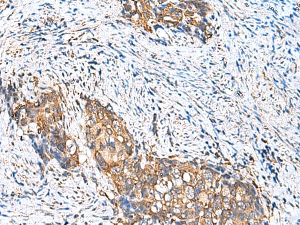 CAMSAP3 / KIAA1543 Antibody