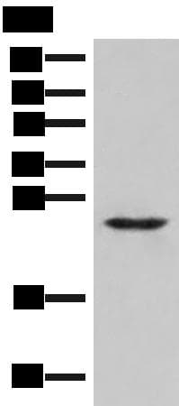 Polyclonal Rabbit anti-Human MRAS Antibody (WB)