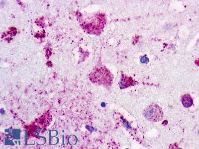 PathPlus™ P2RY1 / P2Y1 Antibody (C-Terminus)