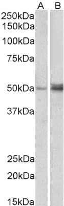 IHC-plus™ FOXL2 Antibody (aa364-376)