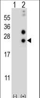 Alpha-S1-Casein / CSN1S1 Antibody (aa36-65)