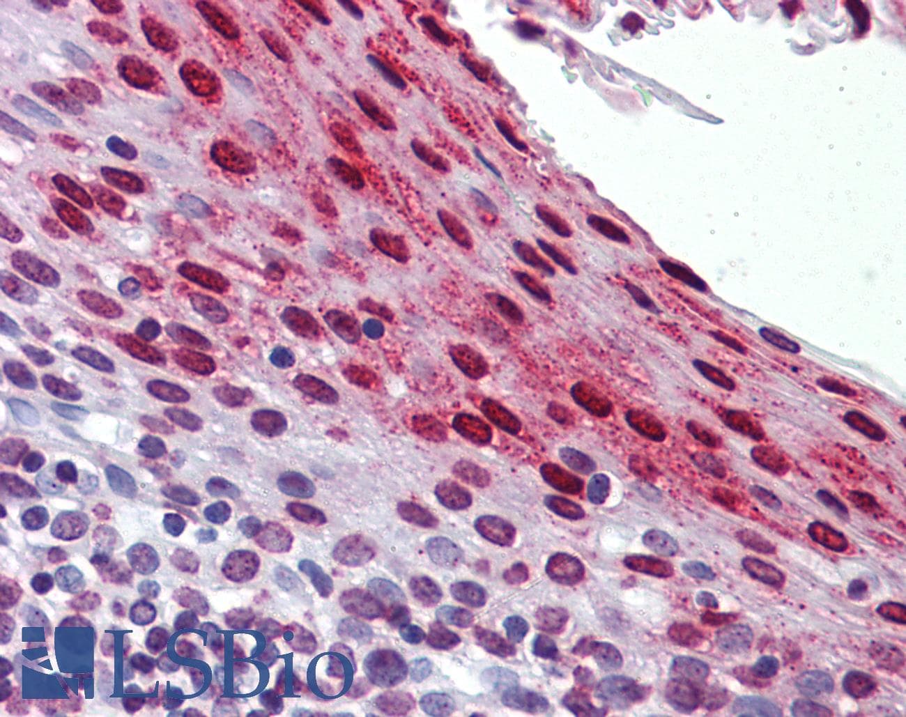 IHC-plus™ Monoclonal Mouse anti-Human CSTB / Cystatin B / Stefin B Antibody (clone M1-C1, IHC, WB)