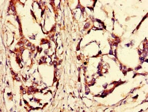 Polyclonal Rabbit anti-Human RPS6KA4 / MSK2 / RSK-B Antibody (IF, WB)