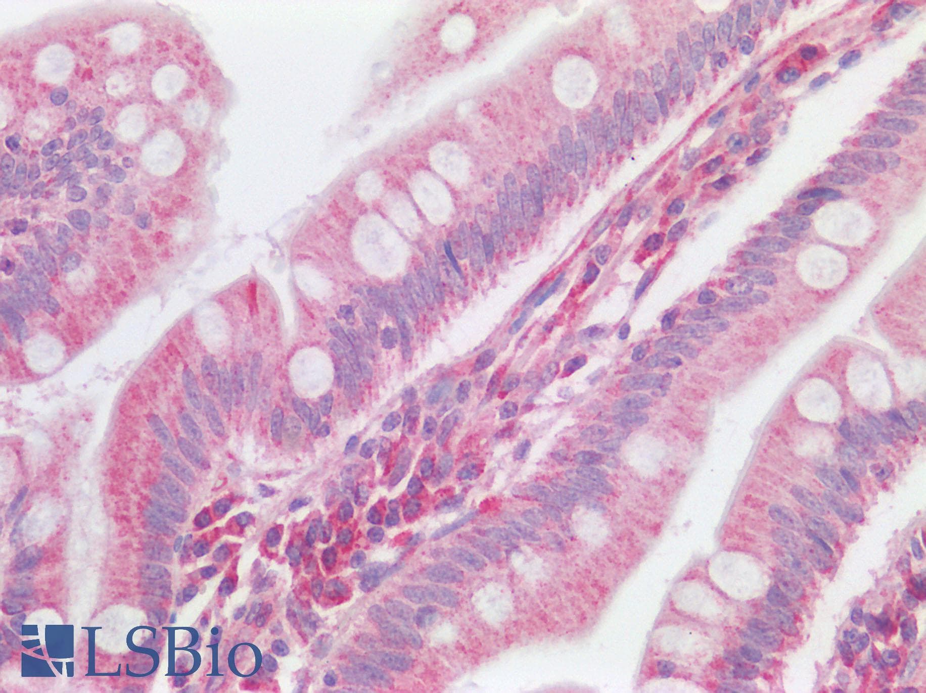 IHC-plus™ TMPRSS2 / Epitheliasin Antibody