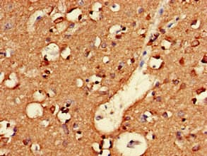 NLGN1 / Neuroligin 1 Antibody