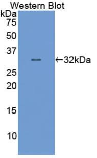 E6AP / UBE3A Antibody (aa158-407, HRP)