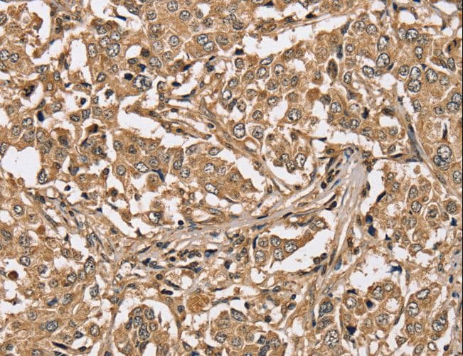 PPP1CC / PP1 Gamma Antibody