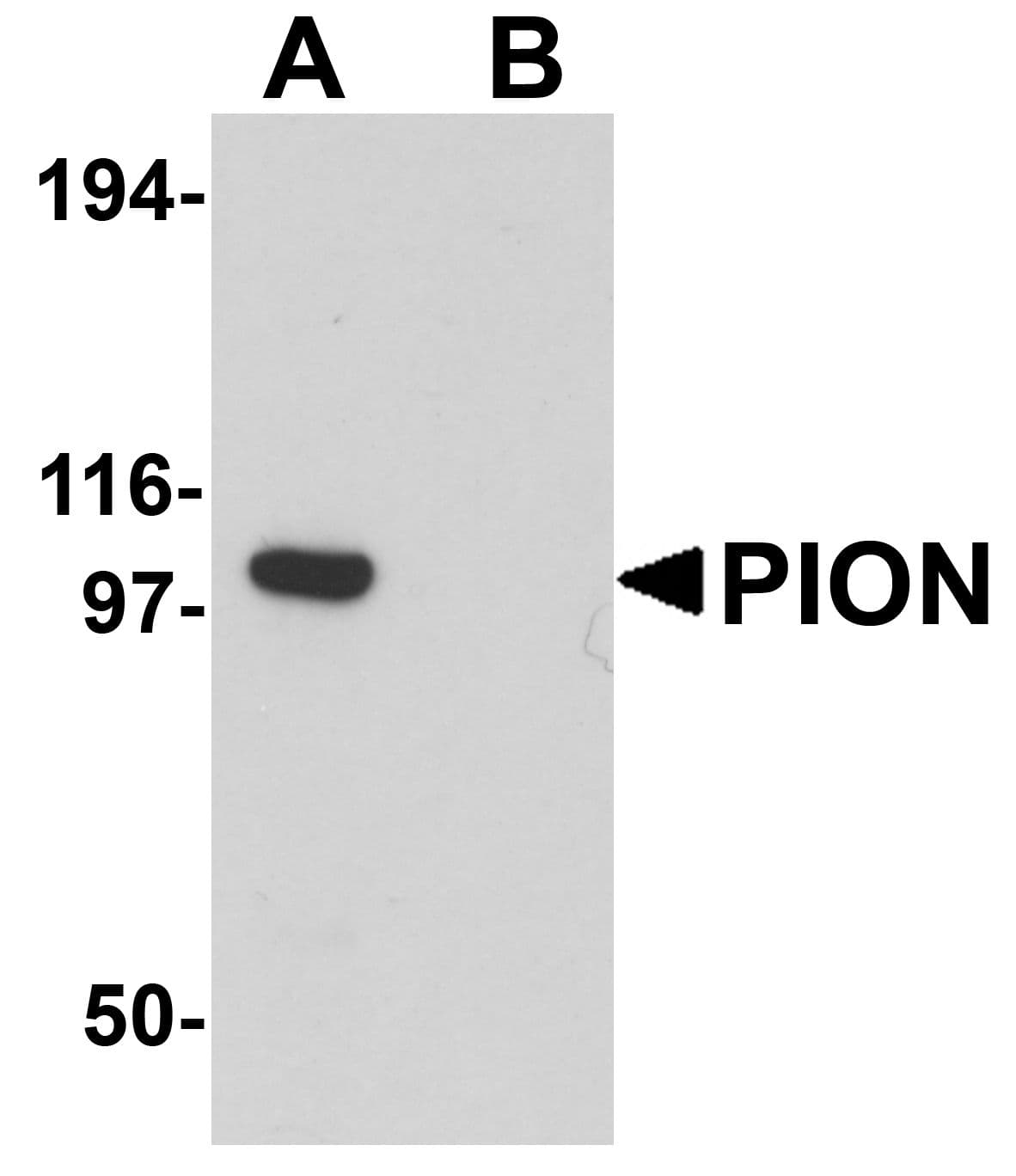 GSAP / PION Antibody