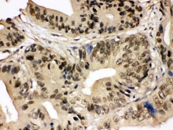 Polyclonal Rabbit anti-Human SMC3 / HCAP Antibody (IHC, WB)