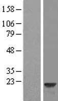 HPCAL1 / Hippocalcin-Like 1 Protein (Over-Expression Lysate Myc-DDK (Flag))