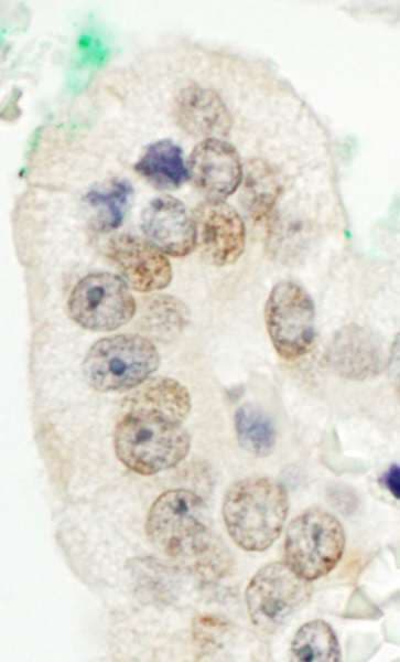 CBX6 Antibody (aa250-300)