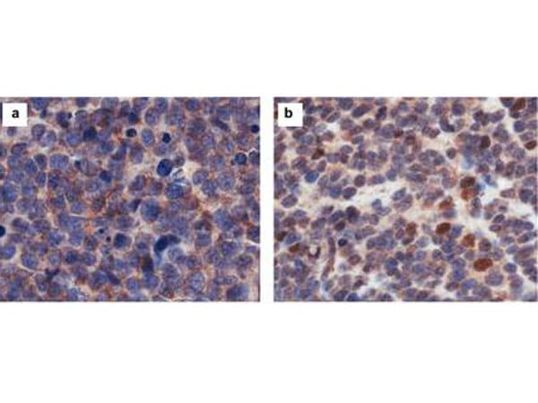 CASZ1 Antibody