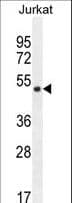 SNIP1 Antibody (aa91-118)