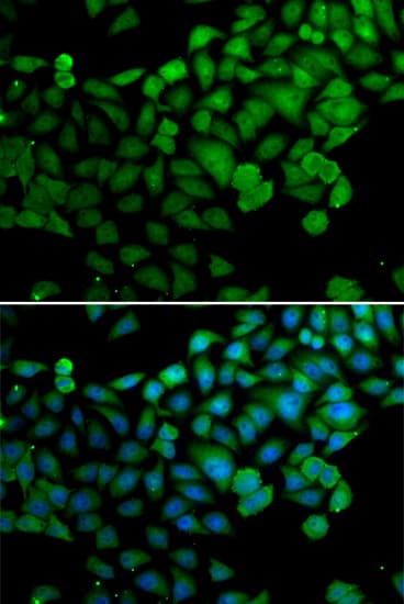 SYNCRIP / HnRNP Q Antibody