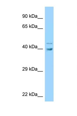 UBE2Q1 Antibody (aa190-239)