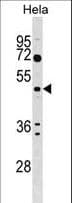 ALG2 Antibody (aa254-282)