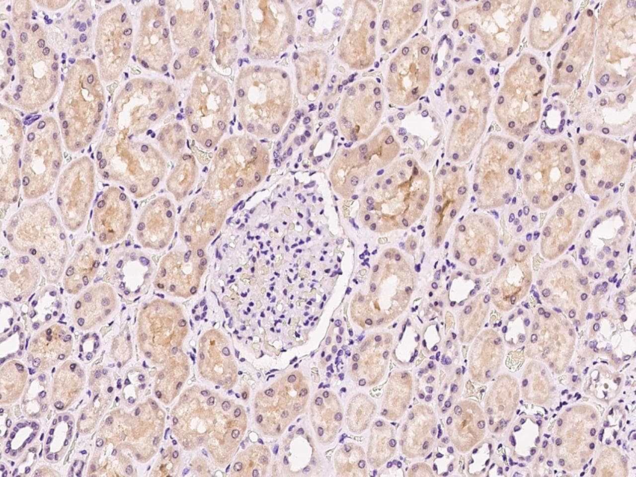 Polyclonal Rabbit anti-Human APBB1 / FE65 Antibody (IHC, IF)