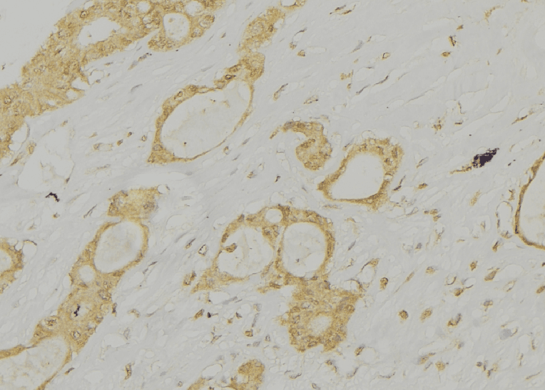 CTSE / Cathepsin E Antibody