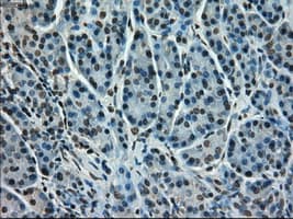 Monoclonal Mouse anti-Human STK39 / SPAK Antibody (clone OTI2E10, IHC, WB)