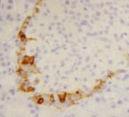 PathPlus™ SST / Somatostatin Antibody (aa1-14)