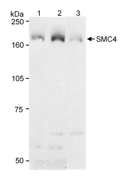 Polyclonal Rabbit anti-Human SMC4 Antibody (aa600-650, IF, WB)