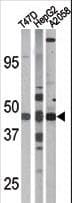 Polyclonal Rabbit anti-Human E2F1 Antibody (phospho-Ser337, IHC, WB)