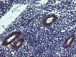 TPD52L3 Antibody (clone OTI8C12)