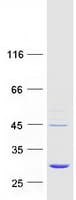 Human EMC9 Protein (Recombinant Myc-DDK (Flag))