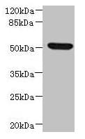 Polyclonal Rabbit anti-Human NDUFV1 Antibody (IHC, WB)