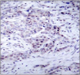 Polyclonal Rabbit anti-Human NFKB2 Antibody (IHC, IF, WB)
