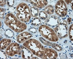 TLDC1 / KIAA1609 Antibody (clone OTI3C4, Carrier-free)