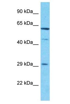 Polyclonal Rabbit anti-Human CCDC107 Antibody (aa52-101, WB)